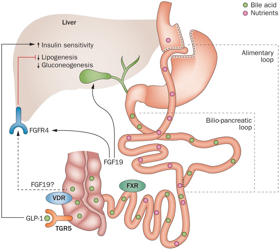 Laparoscopic Roux en Y Gastric Bypass - Obesity Surgery India